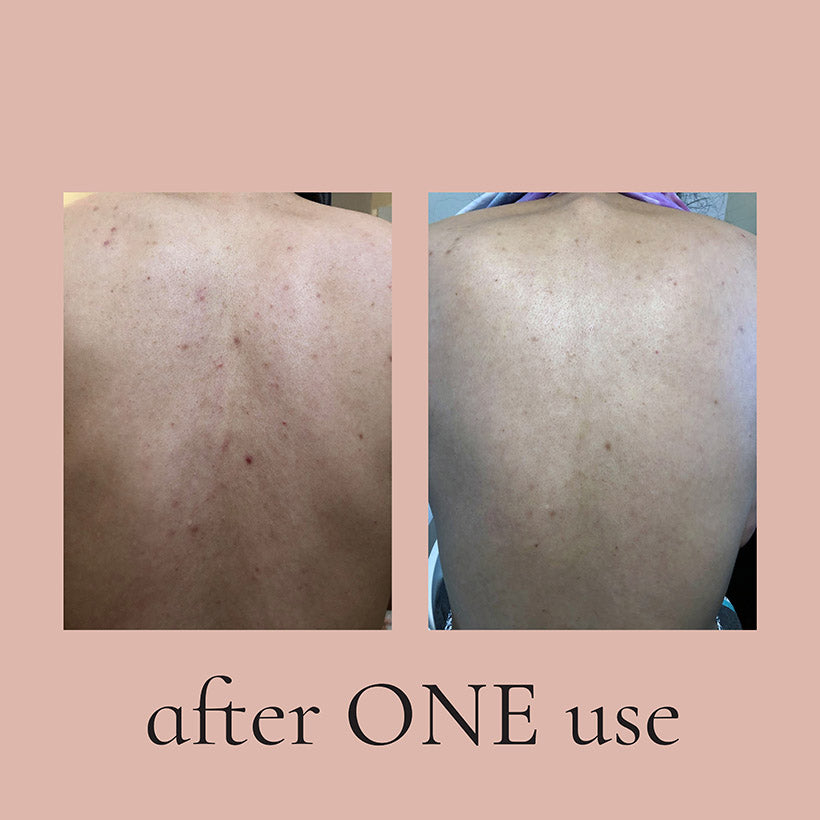 Monyè Co. Exfoliating Pink Body Bundle